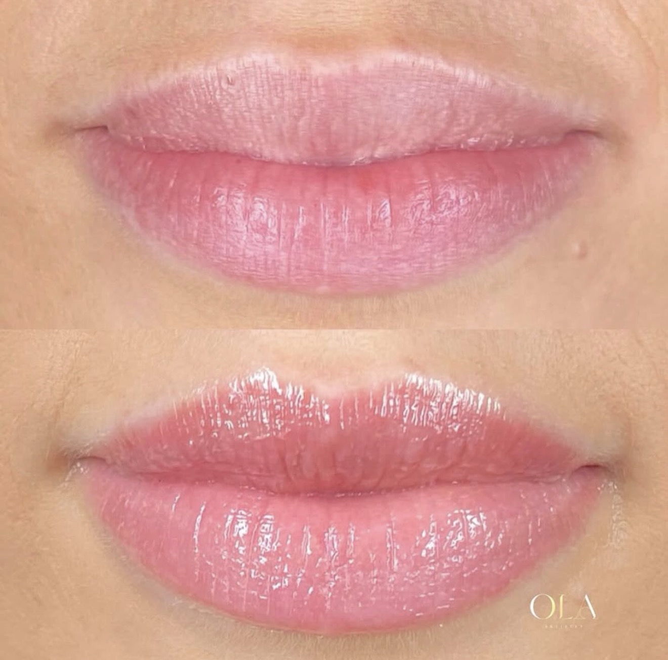 Lip blush result